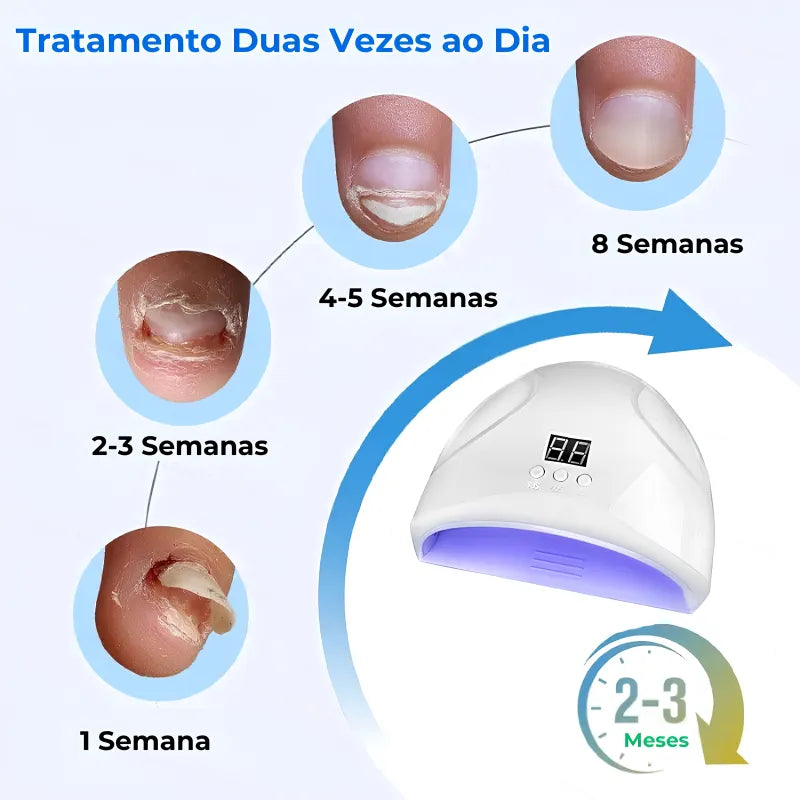 Tratamento das Unhas Jole Store