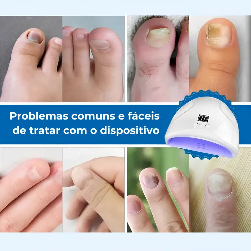 Tratamento das Unhas Jole Store