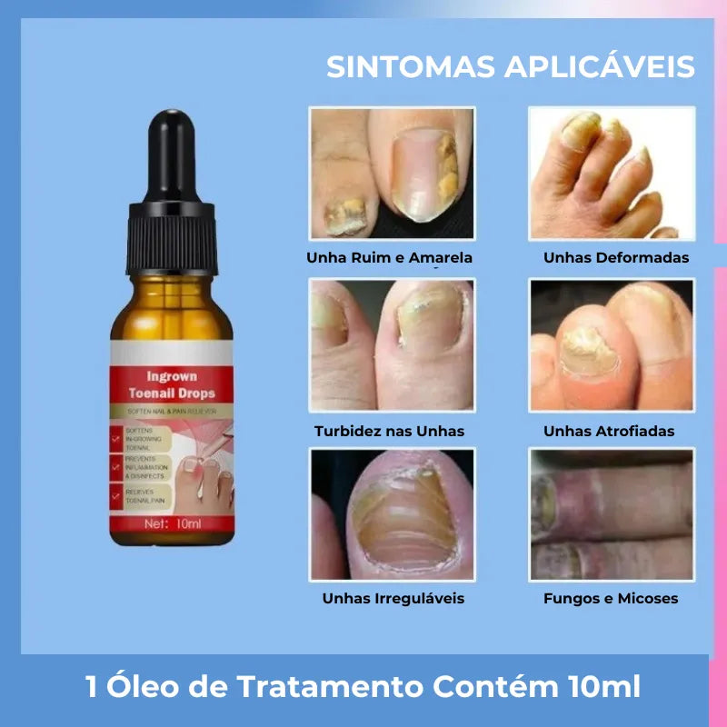 Tratamento das Unhas Jole Store