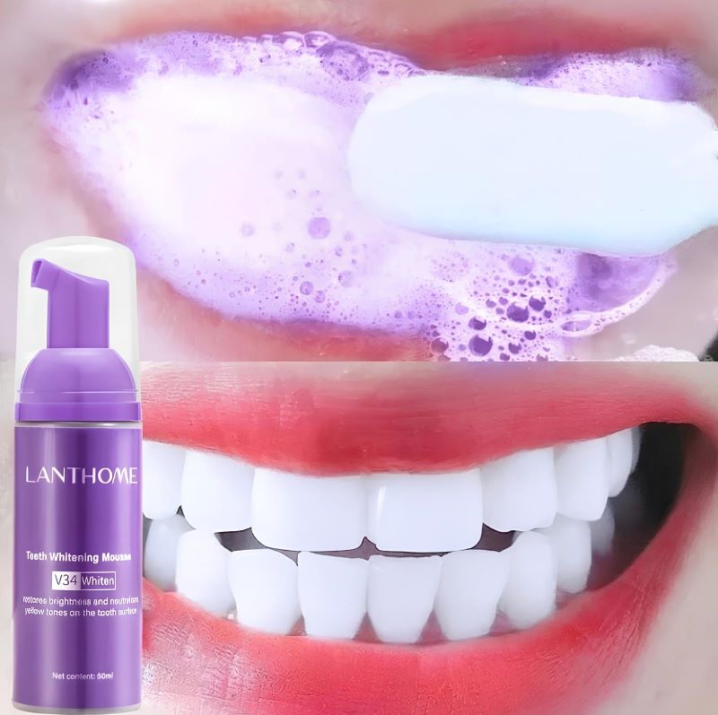 Clareador Dental - Jole Store