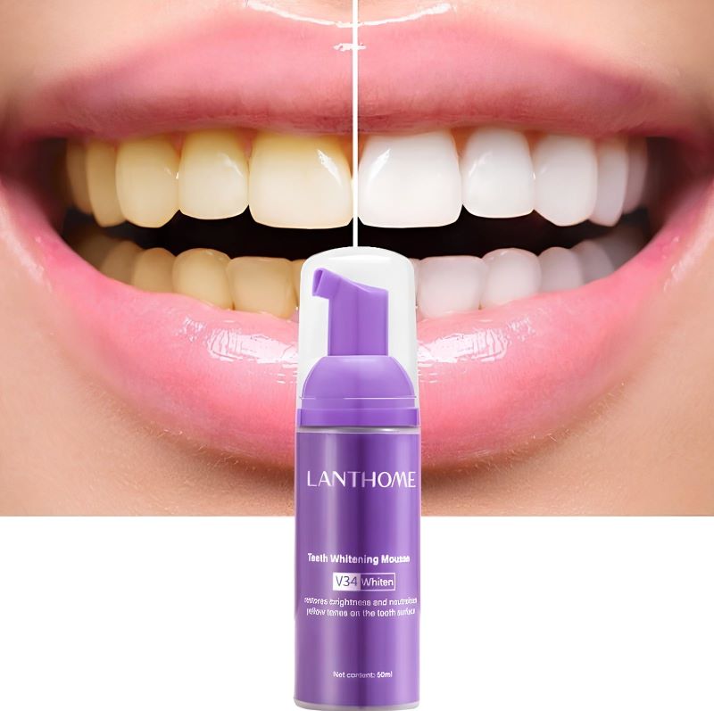 Clareador Dental - Jole Store