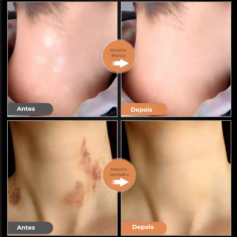 Corretivo Jole Store 