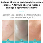 Gel secativo para espinhas Jole Store