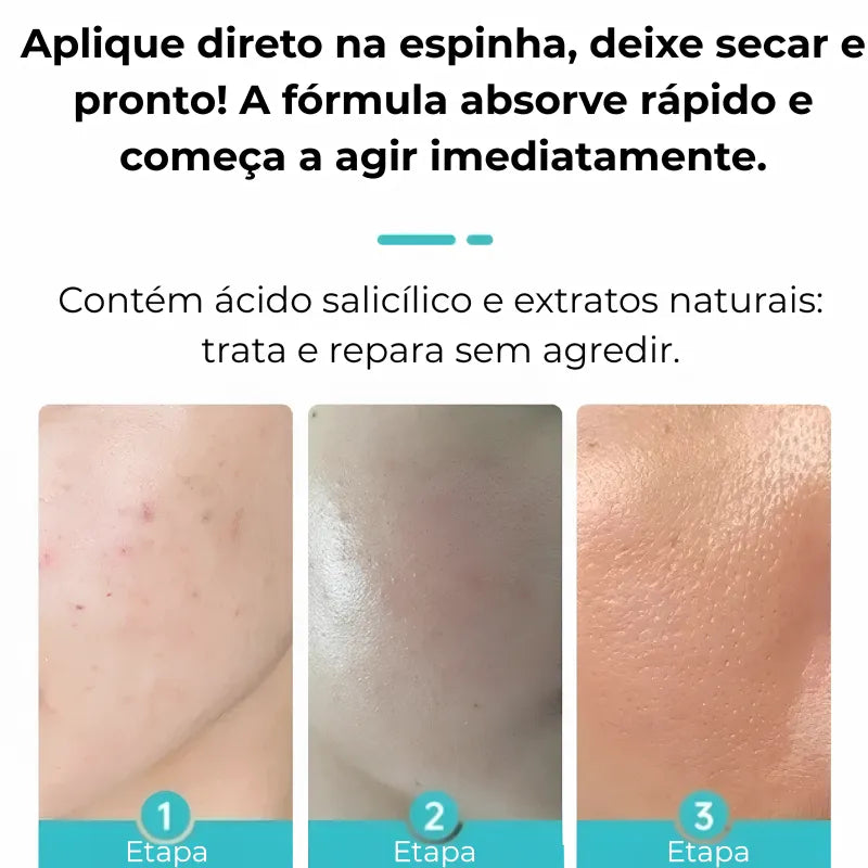 Gel secativo para espinhas Jole Store