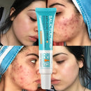 Gel secativo para espinhas Jole Store