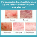 Gel secativo para espinhas Jole Store