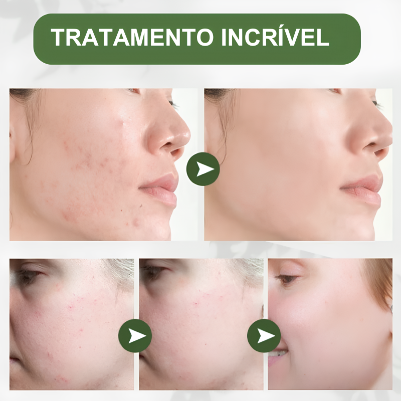 Hidratante Facial - Jole Store