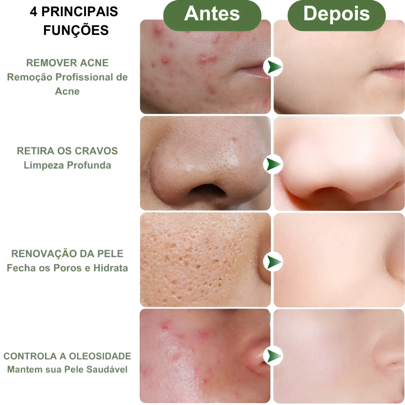 Hidratante Facial - Jole Store