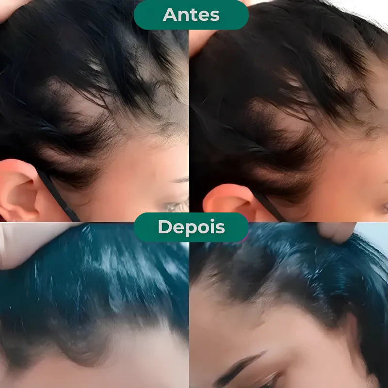 Queda de Cabelo Jole Store