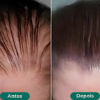 Queda de Cabelo Jole Store