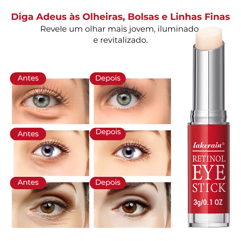 Retinol Para Área dos Olhos – Reduz Olheiras, Bolsas e Linhas Finas