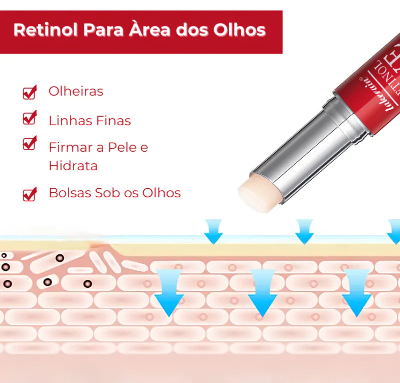 Retinol Para Área dos Olhos – Reduz Olheiras, Bolsas e Linhas Finas