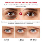 Retinol Para Área dos Olhos – Reduz Olheiras, Bolsas e Linhas Finas