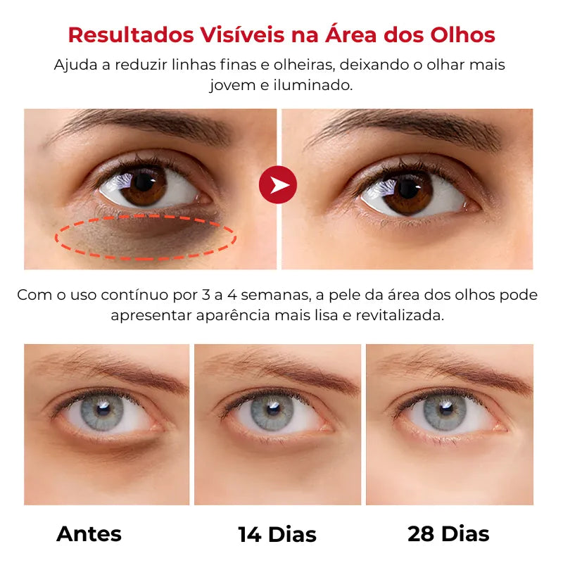 Retinol Para Área dos Olhos – Reduz Olheiras, Bolsas e Linhas Finas