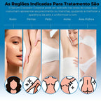 Sérum Clareador Corporal – Reduz Manchas Escuras e Uniformiza a Pele