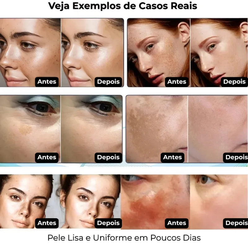 Sérum Facial com Colágeno – Pele Lisa, Uniforme e Iluminada
