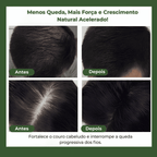 Shampoo Antiqueda em Barra – Herbal Glow Fórmula Asiática