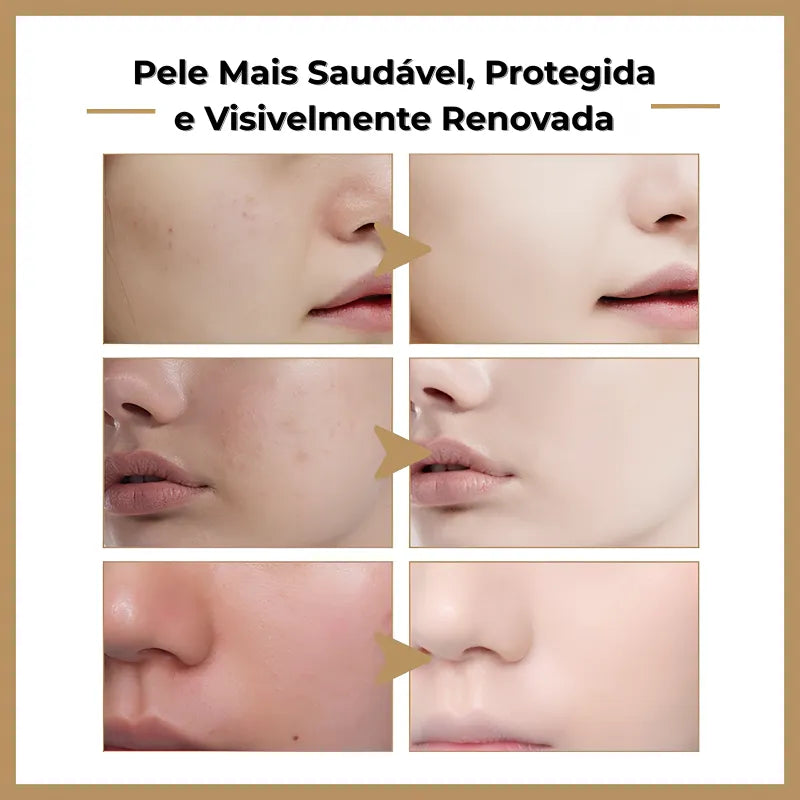 Toner Coreano de Arroz Hidratante e Iluminador