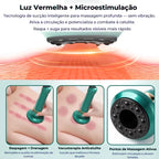 Ventosa SlimTech 12 Níveis– Redução de Celulite e Gordura Localizada